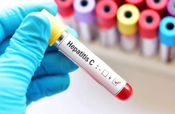 Профилактика заражения гепатитом С 